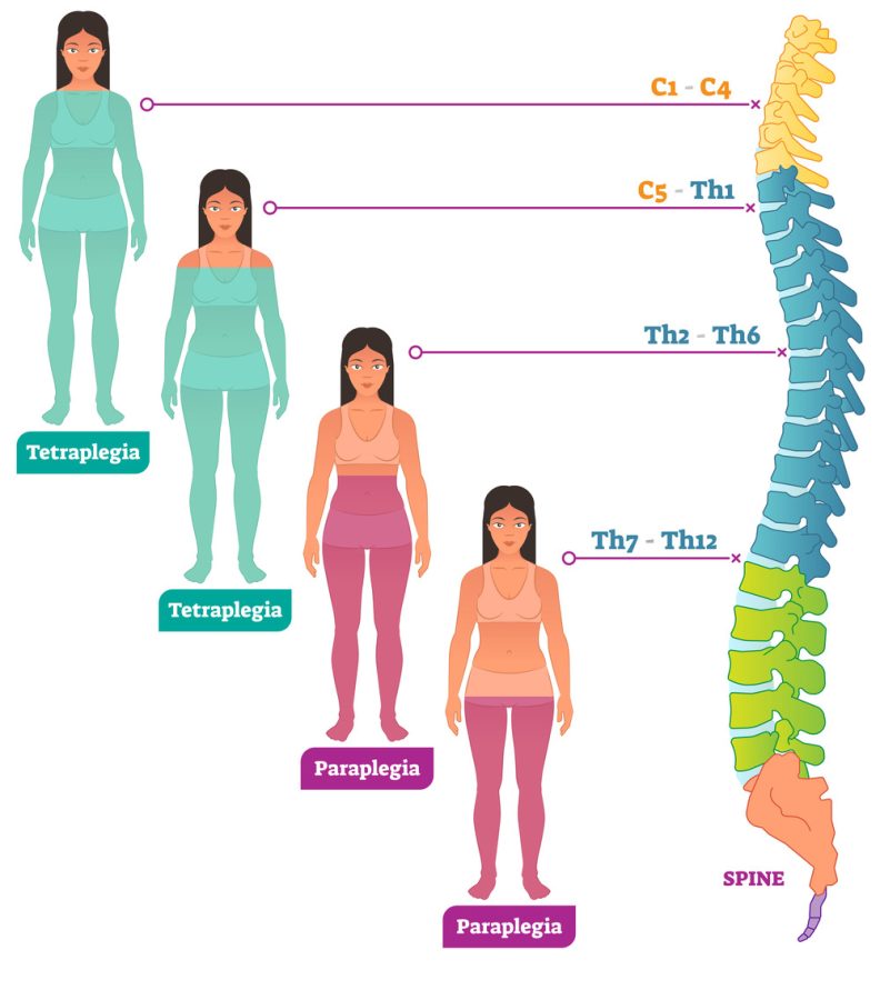 Paraplegie Infografik